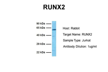 RUNX2 Rabbit Polyclonal Antibody