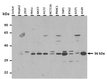 ANXA4 Rabbit Polyclonal Antibody