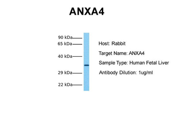 ANXA4 Rabbit Polyclonal Antibody