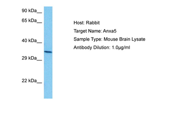 ANXA5 Rabbit Polyclonal Antibody