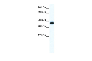 ANXA5 Rabbit Polyclonal Antibody