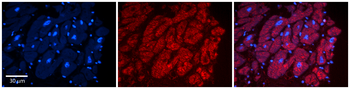 ADAR Rabbit Polyclonal Antibody
