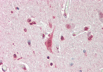 Mxi1 Rabbit Polyclonal Antibody