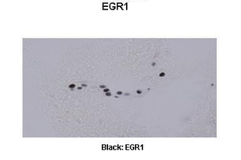 Egr1 Rabbit Polyclonal Antibody
