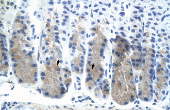 Elf3 Rabbit Polyclonal Antibody