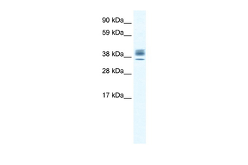 ESX1 Rabbit Polyclonal Antibody