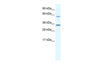 MESP2 Rabbit Polyclonal Antibody