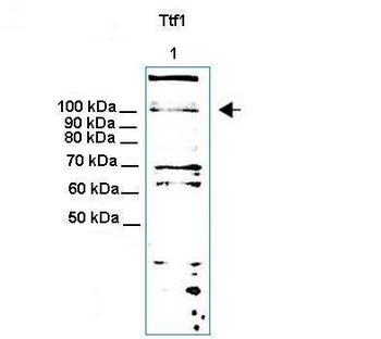 Ttf1 Rabbit Polyclonal Antibody