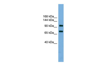 Ttf1 Rabbit Polyclonal Antibody