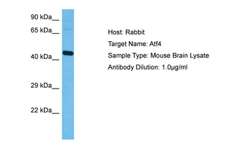 ATF4 Rabbit Polyclonal Antibody