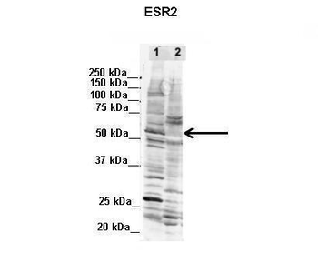Esr2 Rabbit Polyclonal Antibody