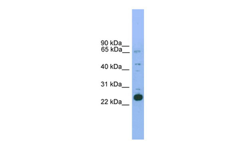 Nkx2-6 Rabbit Polyclonal Antibody