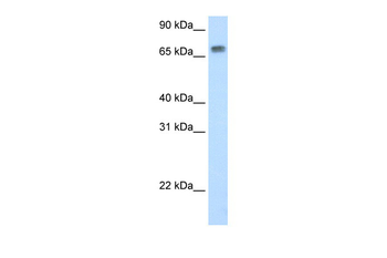 Mta2 Rabbit Polyclonal Antibody