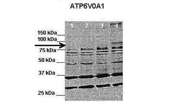 Atp6v0a1 Rabbit Polyclonal Antibody