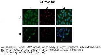 Atp6v0a1 Rabbit Polyclonal Antibody