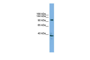 Atp6v0a1 Rabbit Polyclonal Antibody
