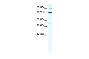 TBX21 Rabbit Polyclonal Antibody