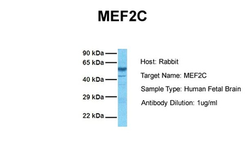 MEF2C Rabbit Polyclonal Antibody