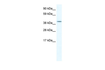 ISL2 Rabbit Polyclonal Antibody
