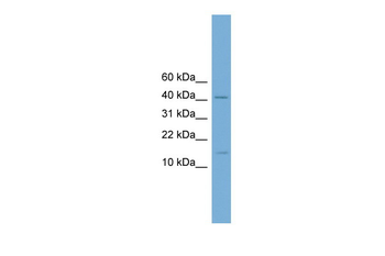 Pbx4 Rabbit Polyclonal Antibody