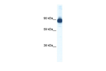 ACTN2 Rabbit Polyclonal Antibody