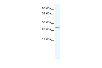 DMRT2 Rabbit Polyclonal Antibody