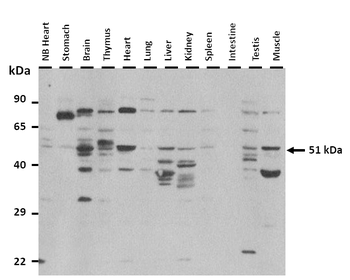 FOXO6 Rabbit Polyclonal Antibody