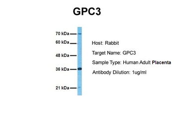 GPC3 Rabbit Polyclonal Antibody