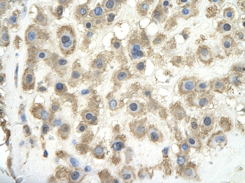 GPC3 Rabbit Polyclonal Antibody