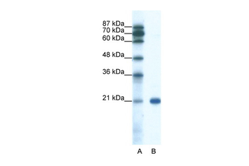 SSX2 Rabbit Polyclonal Antibody