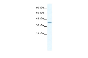 MTA1 Rabbit Polyclonal Antibody