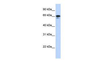 ZNF276 Rabbit Polyclonal Antibody