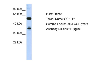 SOHLH1 Rabbit Polyclonal Antibody