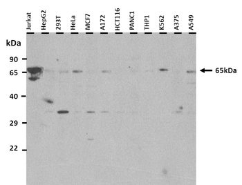 TBX18 Rabbit Polyclonal Antibody