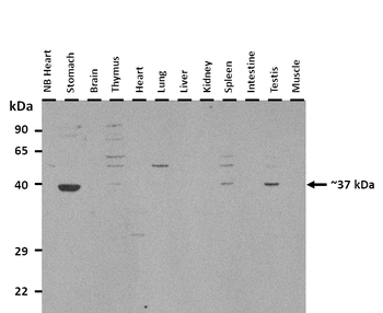 KLF2 Rabbit Polyclonal Antibody
