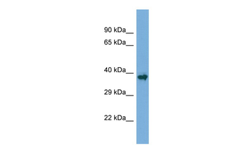 Runx1 Rabbit Polyclonal Antibody