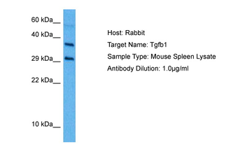 TGFB1 Rabbit Polyclonal Antibody