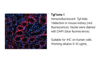TGFB1 Rabbit Polyclonal Antibody