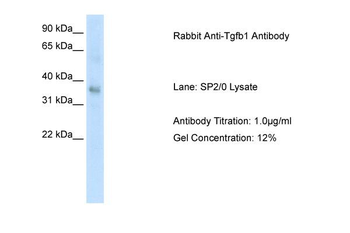 TGFB1 Rabbit Polyclonal Antibody