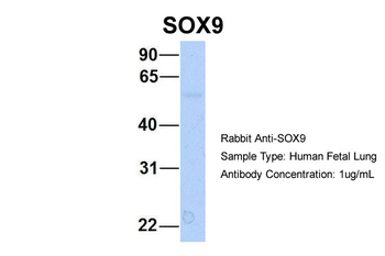 SOX9 Rabbit Polyclonal Antibody