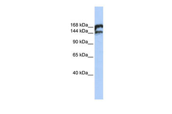 TOP2B Rabbit Polyclonal Antibody