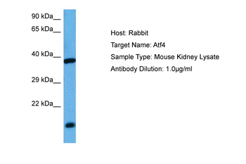 Atf4 Rabbit Polyclonal Antibody
