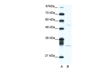 ATF4 Rabbit Polyclonal Antibody