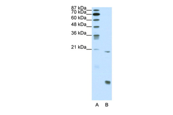 RUNX1 Rabbit Polyclonal Antibody