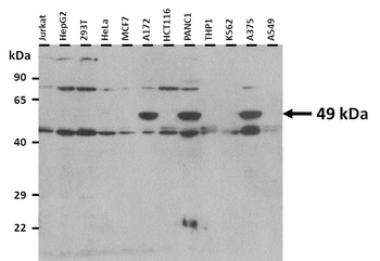 E2F3 Rabbit Polyclonal Antibody