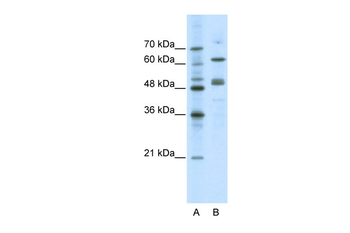 GATA4 Rabbit Polyclonal Antibody