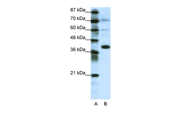 JUN Rabbit Polyclonal Antibody