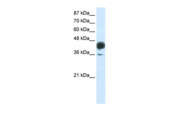 JUNB Rabbit Polyclonal Antibody