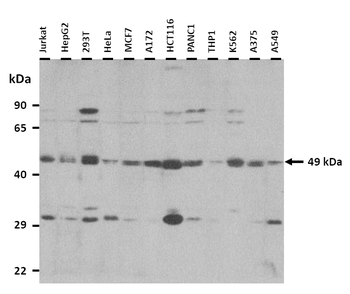MAZ Rabbit Polyclonal Antibody