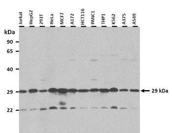 MSX2 Rabbit Polyclonal Antibody